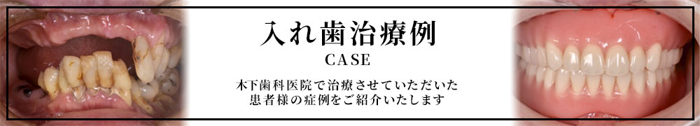 症例 CASE 木下歯科医院で治療させていただいたお客様の症例をご紹介いたします。