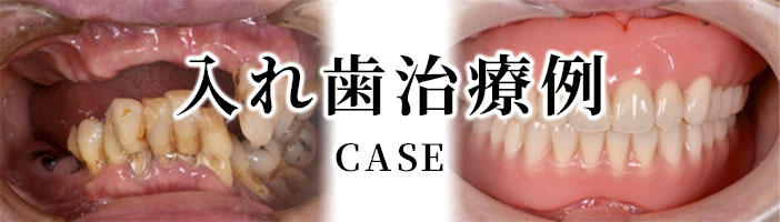 症例 CASE 木下歯科医院で治療させていただいたお客様の症例をご紹介いたします。