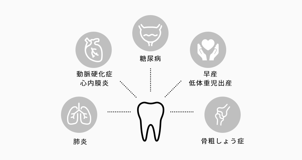 歯周病と全身の関係性