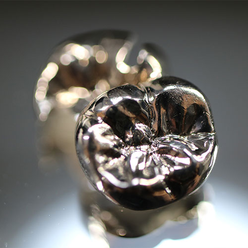 銀歯に代表される“材料制限”という問題