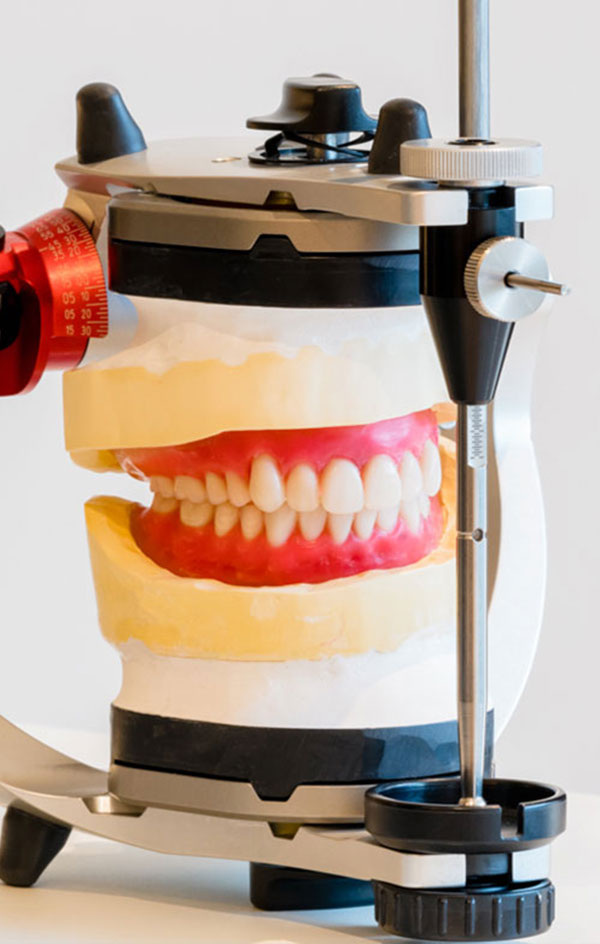 咬合器の違いが噛み合わせの精度を決める