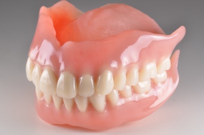 after ６．重度の歯周病を精密義歯にて修復