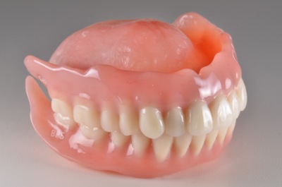 after １７．歯科恐怖症による重度の虫歯を、精密入れ歯にて修復した治療