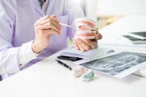 歯の模型で説明している歯科医師