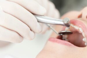 虫歯になりやすいため定期的に歯科検診を受けて予防する様子