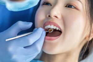 歯科医院でインプラントのメンテナンスを受ける女性