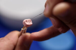 根管治療のやり直しで被せ物を再作成するイメージ