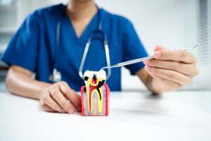 根管治療について説明する歯科医のイメージ