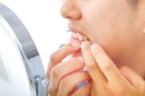 鏡で歯周病を確認する男性