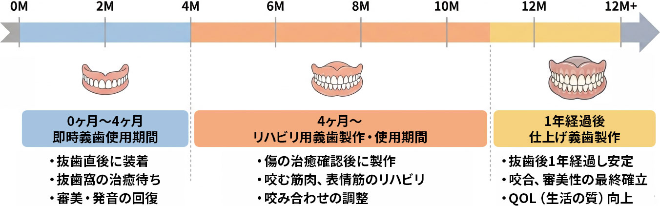 歯を全て抜いて総入れ歯を製作する治療計画は、当院では約1年間で3回入れ歯を製作致します